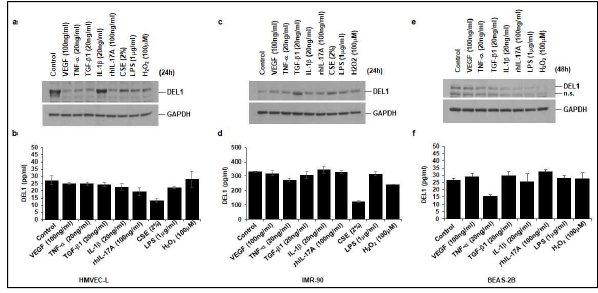 세포 유형에 따른 DEL1 발현조절 인자 규명 : 폐내피 세포, 폐섬유아세포, 폐상피세포 사용. 담 배연기추출물을 포함 해, COPD 발병/진 행에 관여하는 여러 인자를 폐내피세포 (HMVEC–L) (a-b), 폐섬유아세포 (IMR- 90) (c-d), 폐상피세 포 (BEAS-2B) (e-f) 에 처치하고, 세포 총단백에서 DEL1 발현을 Western blot 분석으로 평가 (a, c, e). 세포 배양액 내로 분비된 DEL1 농도를 DuoSet human DEL1 ELISA kit를 사용하여 측정 (b, d, f)