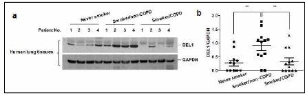 흡연자/non-COPD 환자 폐조직에 DEL1 발현 증가. a, 정상인, 흡연자/non- COPD, 흡연자/COPD 환자 (각 n=12) 폐 조직 수집/급속 동결보관. 동결 폐조직에 서 총단백 추출. DEL1 발현을 Western blot 분석으로 평가. b, Scion image 프로 그램을 이용하여 DEL1, GAPDH band 밀도측정