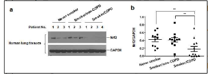 흡연자/COPD 환자 폐조직에서 Nrf2 발현 감소. a, 정상인, 흡연자/non-COPD, 흡 연자/COPD 환자 (n=12)의 동결 폐조직에서 총 단백을 추출. Nrf2 발현을 Western blot 분석으 로 평가. b, Scion image 프로그램을 이용 Nrf2, GAPDH band 밀도측정