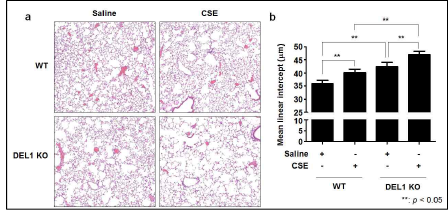 WT 생쥐와 비교해 DEL1 KO 생쥐 에서 CSE 처치로 유도된 폐기종이 더욱 악화됨. a, C57BL/6 DEL1 WT, KO 생쥐 에서 적출한 폐조직을 4% paraform aldehyde에 고정. paraffin block 제작. Section후 hematoxyline & eosin (H&E) 염색수행. 폐기종 정도를 평가하기 위하 여 MLI 측정