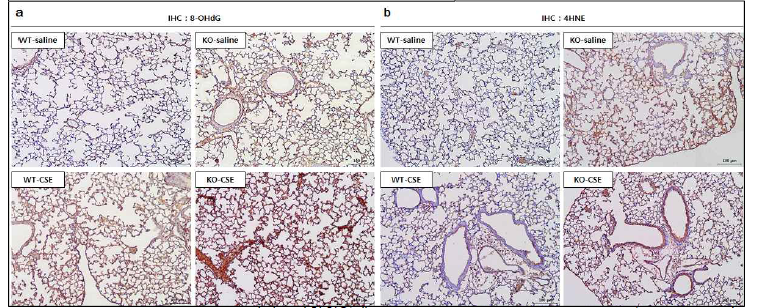 Oxidative stress marker 면역조직화학염색. DNA oxidation marker 8-OHdG (8-Hydroxy-2’- deoxyguanosine) (a), lipid peroxidation에 의해 생성되는 4HNE (4-Hydroxynonenal) (b)에 대한 면역 조직화학염색 수행. *DEL1 KO-CSE 그룹에서 8-OHdG, 4HNE 발현이 가장 높음