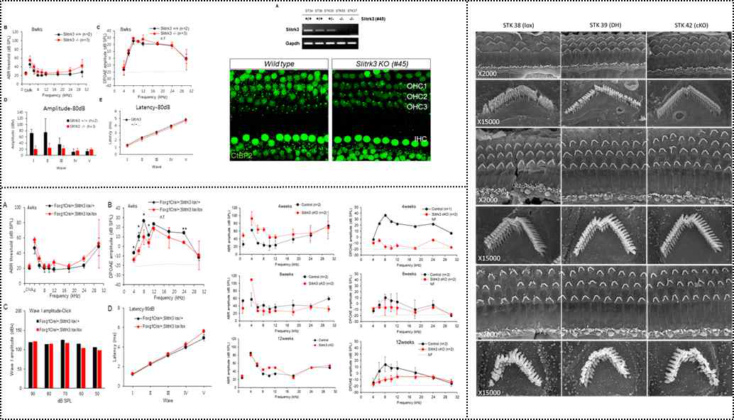 Slitrk3 KO 청력 및 synapse 관찰 결과, Slitrk3cKO (Foxg1cre/+) 청력 및 Slitrk3 cKO (Pax2-Cre) 청력 측정 결과, 부동섬모 관찰 결과