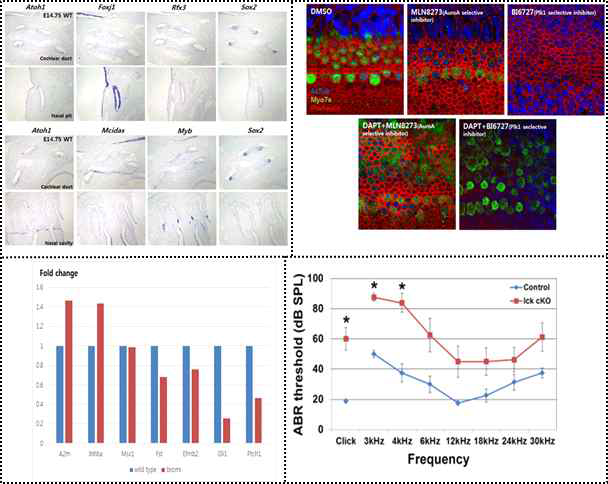 Notch signaling 하위 전사인자 발현양상, AuroraA, PIK1 저해제 이용하여 섬모형태 관찰, Bromi 마우스에서 유전자 발현 양상 비교 Ick cKO (Foxg1cre/+) ABR 결과