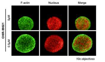 CHIR-99021에 의한 간 섬유화 구상체 내 세포간 치밀성 변화