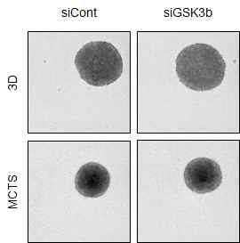 GSK3β의 발현에 따른 구상체 모델의 크기 및 모양 변화