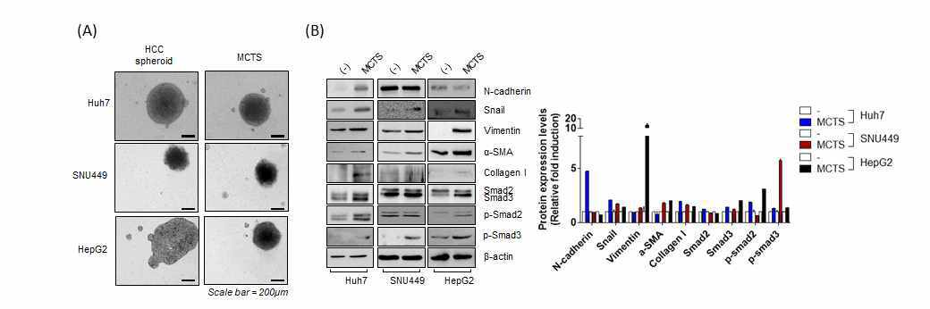간암세포주의 3차원 배양과 간 섬유화 구상체의 견고함 비교(A), 간 섬유화 구상체에서의 세포외기질-, EMT 관련 단백질의 발현(B)