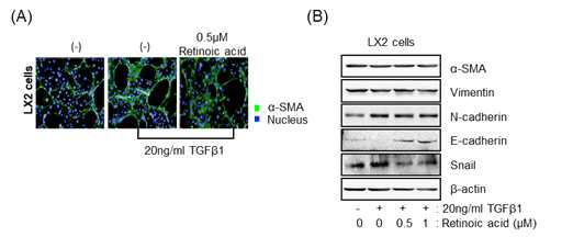 20ng/ml TGF-β1과 retinoic acid를 LX2 세포에 동시 처리 후 a-SMA 이미지 염색 (A) 및 관련 단백 질 변화 (B)