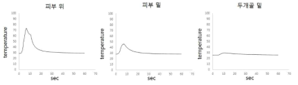 흰주의 피부 위 피부 밑 두개골 밑 온도 그래프