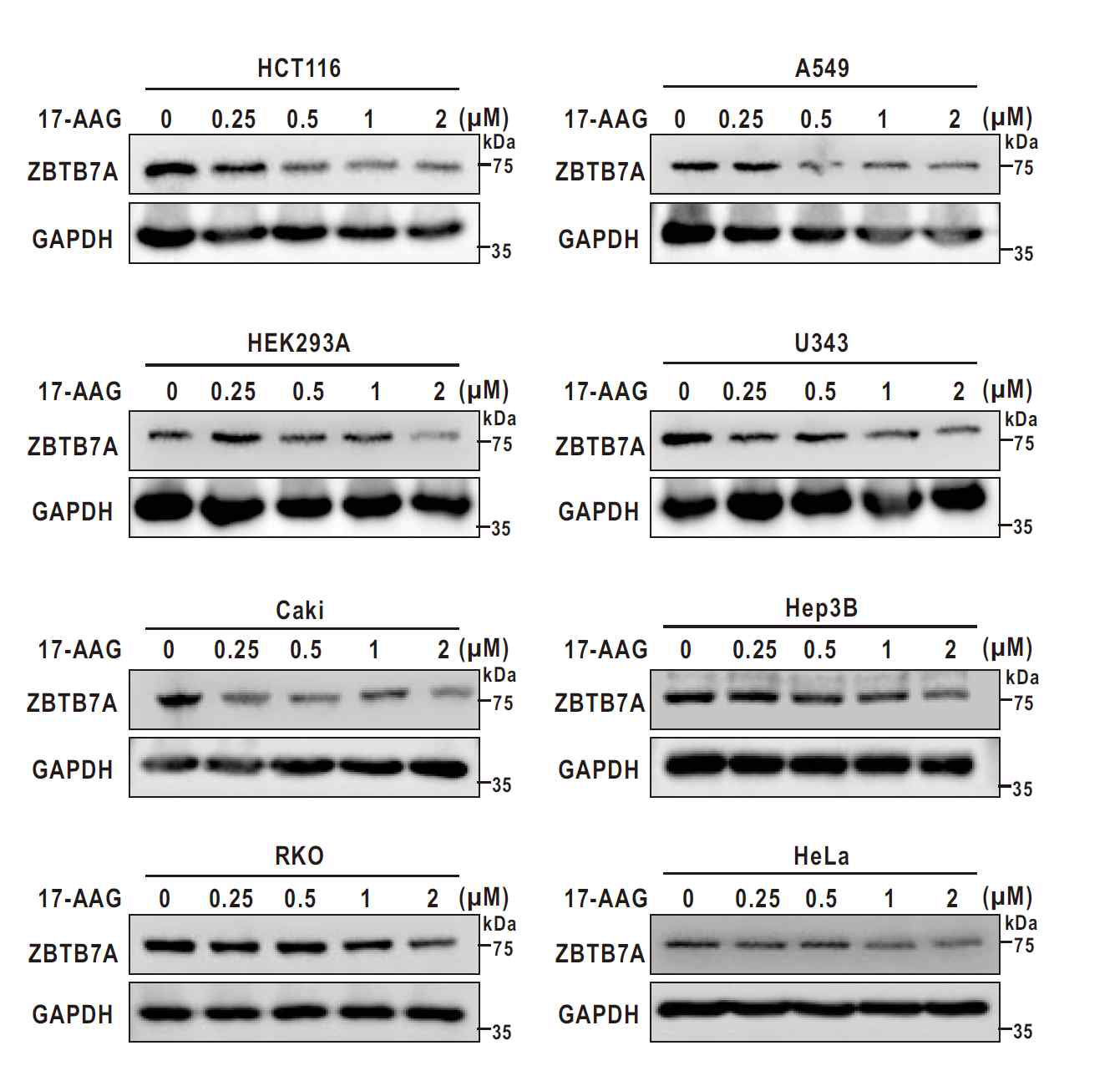 HSP90 inhibitor treatment decreases ZBTB7A expression in various cancer cells