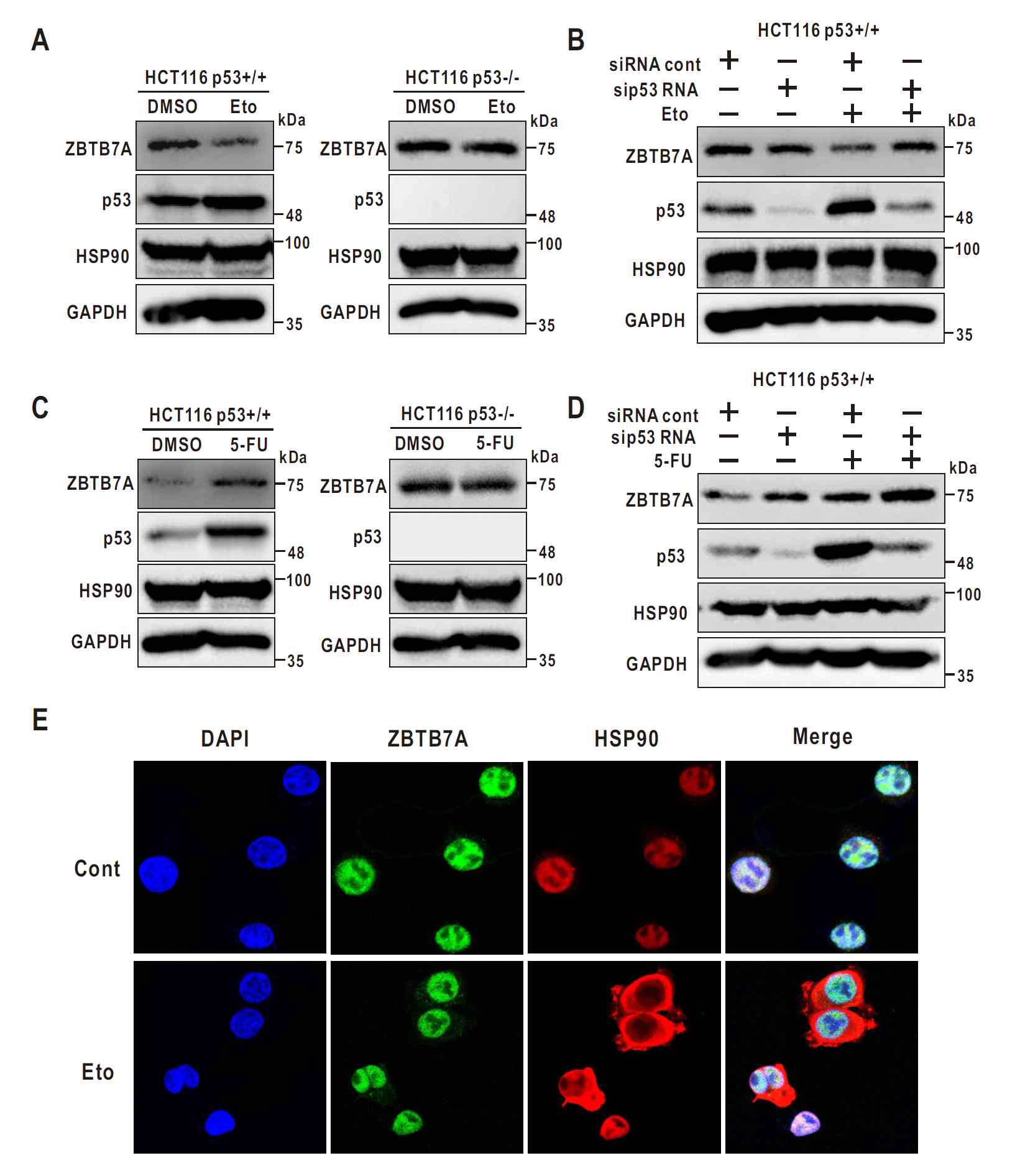 ZBTB7A and HSP90 colocalize in the nucleus, but HSP90 is exported upon treatment with etoposide