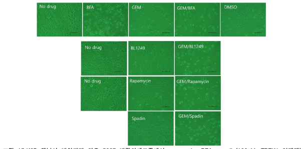 채널이 발현되지 않은 5637 방광암세포주에서 rapamycin, BFA, spadin(100nM, TREK1 억제제), BL1249(5μM, TREK 활성제), gemcitabin(20μM, 항암제)처리후 세포모양의 변화