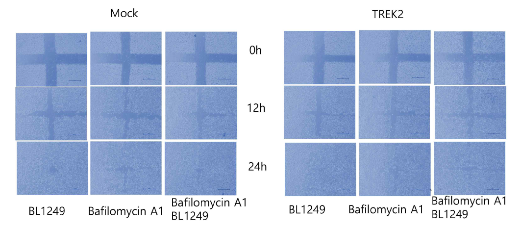 방광암 세포주(5637)에서 TREK2 과발현, TREK 활성제(BL1249, 10 μM), autophagy 엑제제(bafilomycin A1 100nM)에 의한 세포의 이주 효과