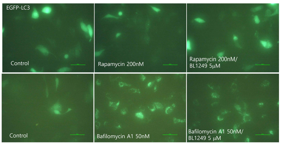 5637 봥광암세포주에서 autophagy 유발제인 rapamycin(200nM) 과 bafilomycin A1(50nM), TREK 활성제 BL1249(5μM) 처리시 LC3 punta 의 변화