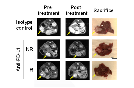 Anti-PD-L1 항체 처리 후, MRI로 orthotopic 종양 크기 변화를 관찰한 representative image로 비반응군(NR)에 비해 반응군(R)의 종양 크기가 현저히 줄어 들었음