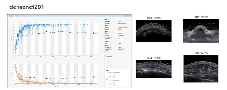 매틀랩(MATLAB)을 이용한 얼굴 초음파 영상 교육 예시. densenet201모델을 이용한 얼굴 지점 분류 평가 교육 과정(왼쪽) 및 검증(오른쪽)