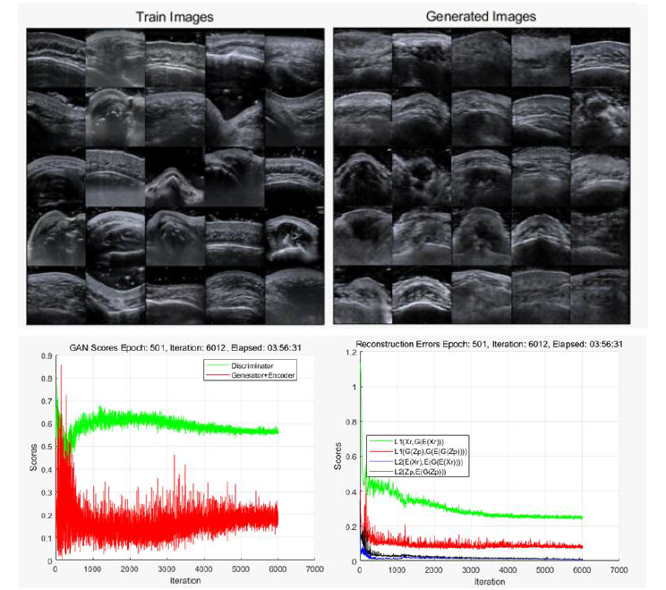 적대적생성신경망의 교육이미지와 생성이미지(왼쪽), 교육과정(오른쪽). 초음파 이미지로부터 충분한 특징을 얻지 못해 60% 이상의 훈련이 불가능함(과소적합)