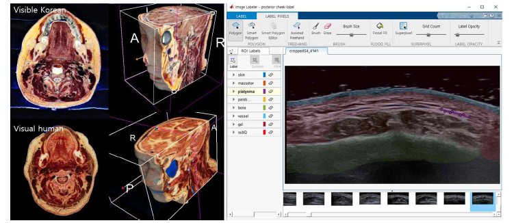 냉동절편 사진과 컬러삼차원인체모델(왼쪽). 매틀랩 주석작업도구(오른쪽)