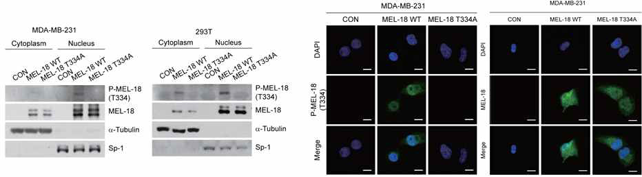 Mel-18 T334 부위 인산화된 Mel-18 단백질의 세포 내 위치