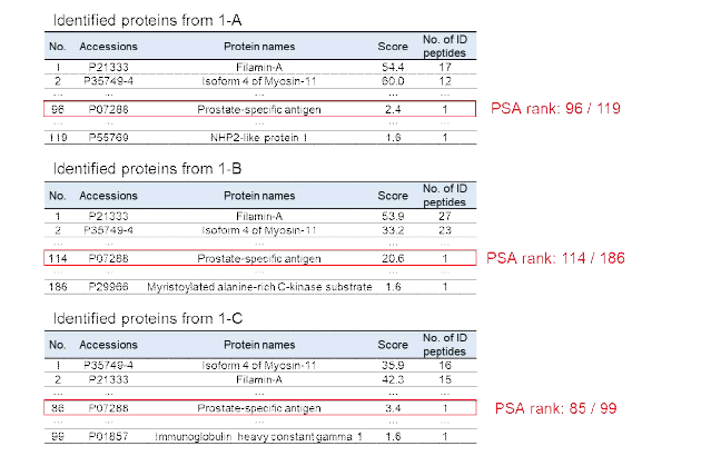 상대적으로 높은 혈중 PSA 농도 (13.2 ng/mL)를 보이는 전립선암 조직의 단백질 리스트 및 PSA 순위