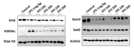 Pharmacological underlying mechanisms of GYJ and OYJ via mediations of different signaling pathway. GYJ mainly regulates Sirt6 and OYJ mediates Sesn3 against neuroinflammation by LPS injection of mice hippocampus regions of brain tissue