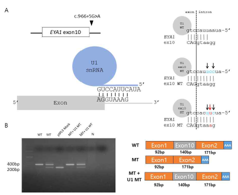 EYA1 유전자의 c.966+5G>A 돌연변이를 치료하기위한 U1 snRNA 제작 및 치료효과 확인