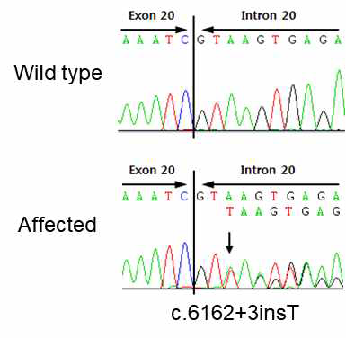 DFNA5 유전자에서 발견된 스플라이싱 돌연변이 분석