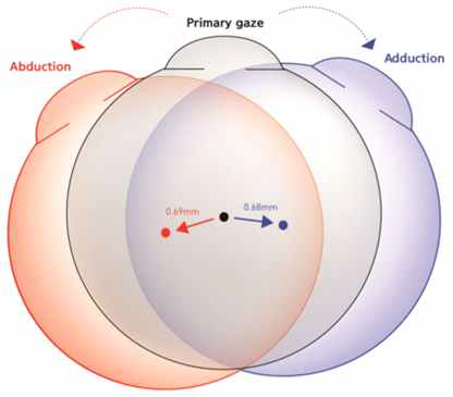 수평방향 주시 시 안구는 같은 방향으로 움직임을 나타낸 모식도