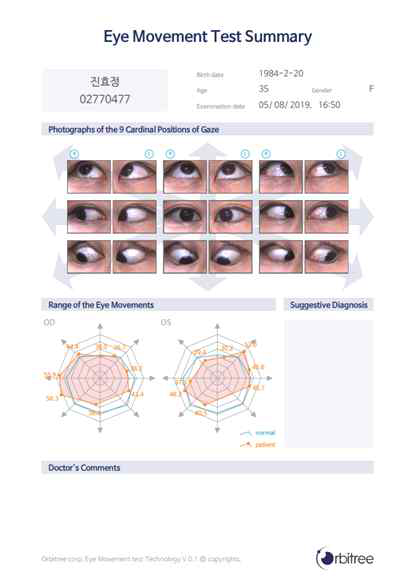 눈 운동 및 사시각 측정 결과지