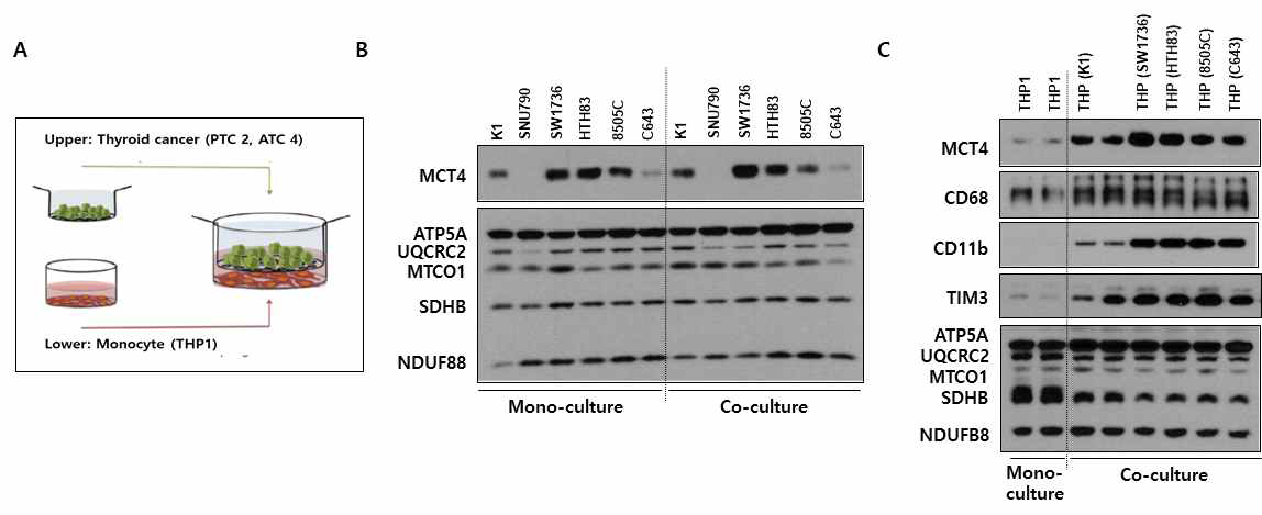 갑상선암 세포주와의 공동 배양을 통한 단핵구의 분화 및 MCT4/TIM3 발현 변화