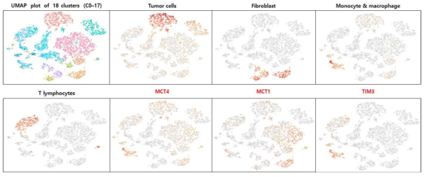 갑상선암 조직을 활용한 scRNA-seq 및 MCT4 발현 세포 규명 (대표적 증례)