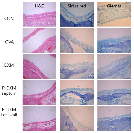 Rat 비강 조직 소견. CON, control, 대조군; OVA, ovalbumin, PBS 주입군; DXM, dexamethasone 주입군; P-DXM, dexamethasone-microparticle 주입군