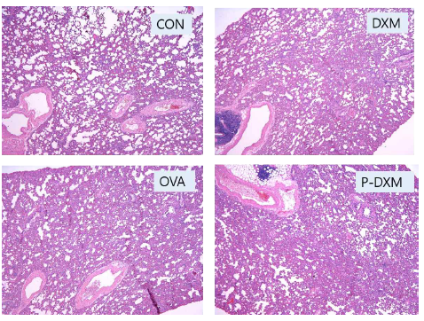 Rat lung H&E stainin