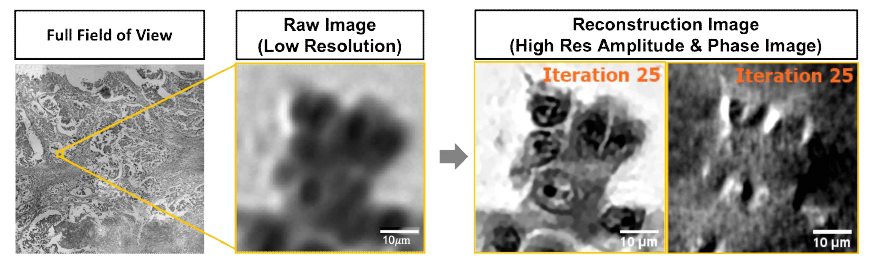 histology slide를 시료로 활용해 복원한 75.69M 픽셀 고해상도 이미지와 복원전과 복원 후의 amplitude & phase 이미지 비교