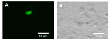 GFP-exosome 플라스미드 발현 사진