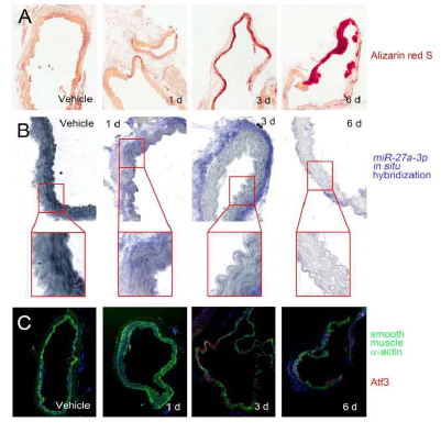 miR-27a-3p에 의한 혈관석회화 유발. 혈관석회화가 유발된 생쥐에서 miR-27a -3p의 발현이 줄어들고 이와는 반대로 ATF3의 발현이 증가됨 (Choe 등, Mol Ther Nucleic Acids, 2020 IF: 8.9)