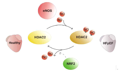 nNOS에 의한 HDAC2의 S-nitrosylation 과 이에 의한 HFpEF의 발생 (Yoon 등, Circulation , 2021, IF: 29.7)