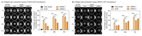 (A) NR2F1-AS1과 (B) FOXC2-AS1의 발현을 억제하고, 세포들을 콜라겐 젤 위에 띄운 후 수축분석을 수행함. 긴 비암호화RNA 발현이 억제되면 젤 수축 정도가 감소함을 확인하였음