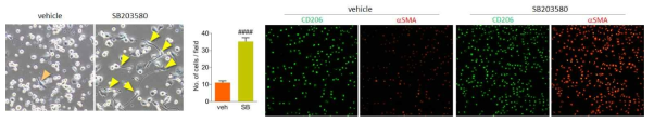 p38활성이 억제된 대식세포의 세포전이 징후인 세포모양 변화와 근섬유아세포 마커의 발현이 증가함