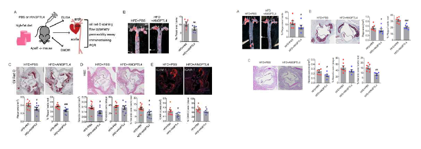 Apoe와 Ldlr 적중 마우스의 동맥경화증 모델에서 ANGPTL4 처리에 의한 항동맥경화 효과를 검증함 (submitted)