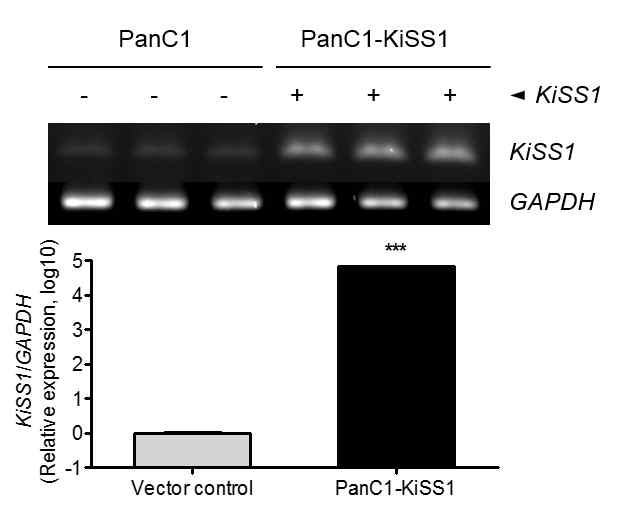 KiSS1 유전자의 과발현 확인