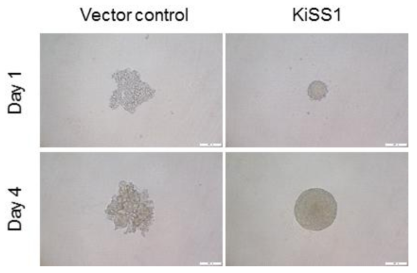 KiSS1 과발현에 따른 췌장암 스페로이드 크기 변화 비교