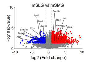 Bulk RNA 데이터 기반 volcano plot을 통한 SMG-SLG 비교