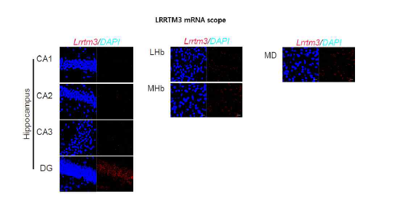 해마와 시상에서 LRRTM3 발현 패턴 (unpublished observations)