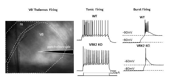 VRK2 녹아웃 마우스에서 시상 전달핵 신경세포의 발화패턴 (unpublished observations)