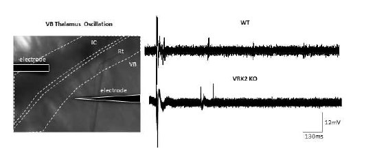 VRK2 녹아웃 마우스에서 시상 오실레이션 패턴 변화 분석 (unpublished observations)