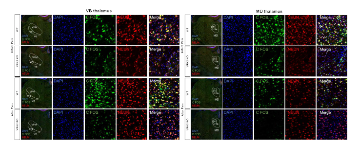VRK2 녹아웃 마우스의 VB thalamus(왼쪽)와 MD thalamus(오른쪽)에서의 c-fos 발현 분석 (unpublished observations)