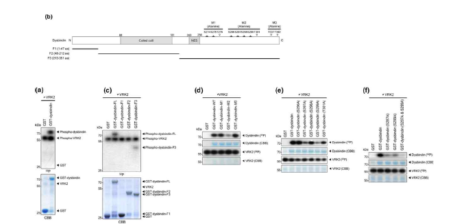 VRK2의 dysbintin 인산화 조절 분석 결과 (adapted from Jeong et al. 2018 J Neurochem)