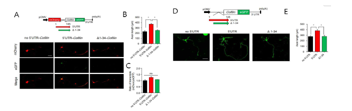 cofilin의 IRES 매개 발현이 뉴런의 성장에 미치는 영향 (adapted from Jung et al. Sci Adv 2020)