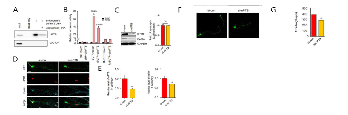 nPTB가 뉴런의 성장에 미치는 영향 (adapted from Jung et al. Sci Adv 2020)