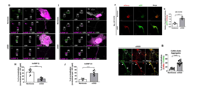 cOGD 상황에서 hnRNP Q와 hnRNP A1의 위치 변화 분석 (adapted from Jung et al. Sci Adv 2020)